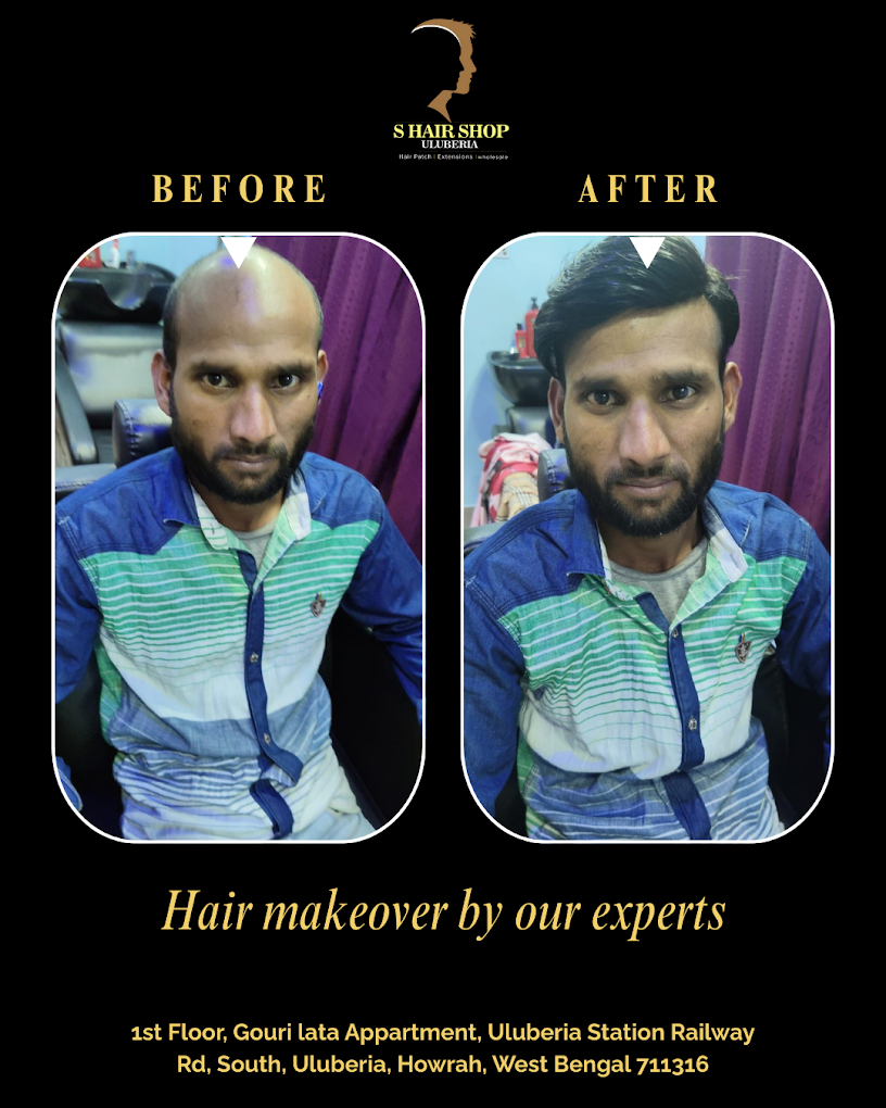 Best Hair Patch Clinic in Uluberia Howrah - S Hair Wig Shop